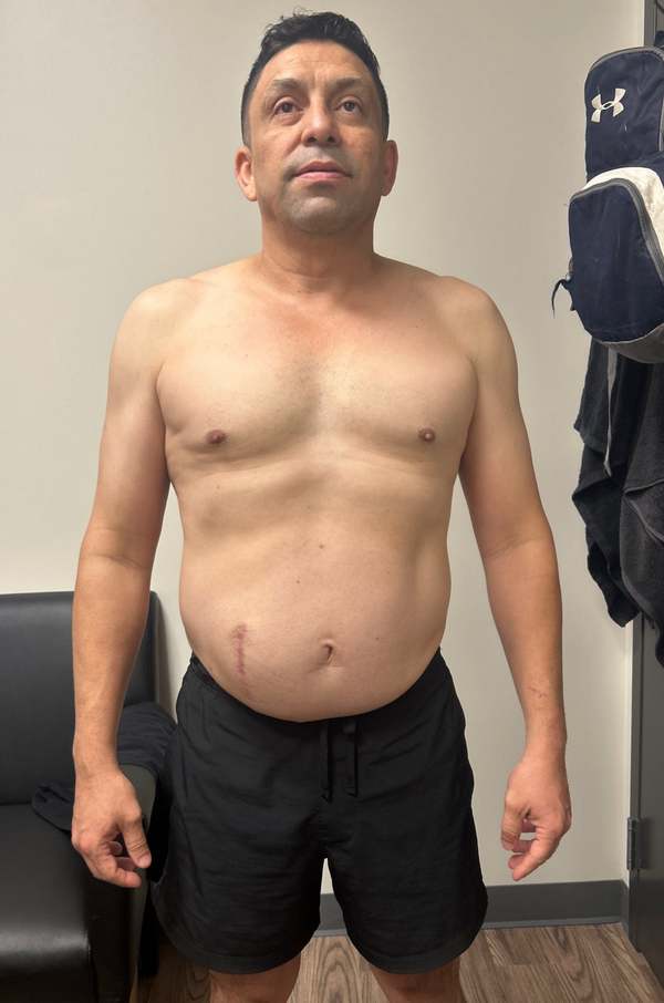 After image for client