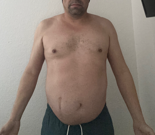 Before image for client