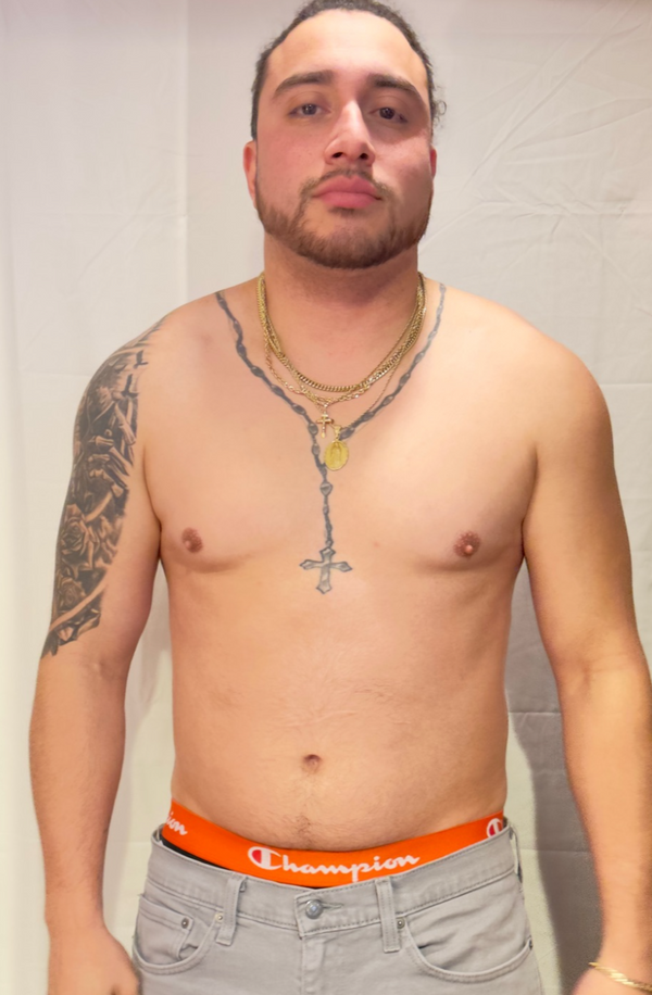 Before image for client